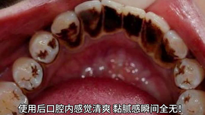 牙：这把高端局